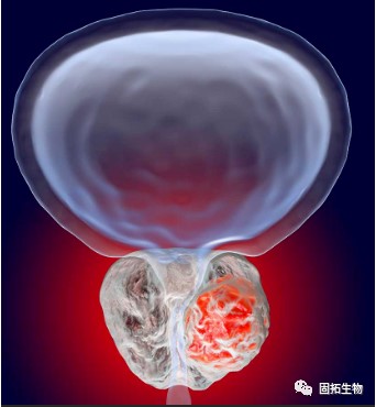 前列腺癌新藥！基肽酶抑制劑talabostat聯(lián)合Keytruda在腺癌表型晚期難治性mCRPC療效令人鼓舞!